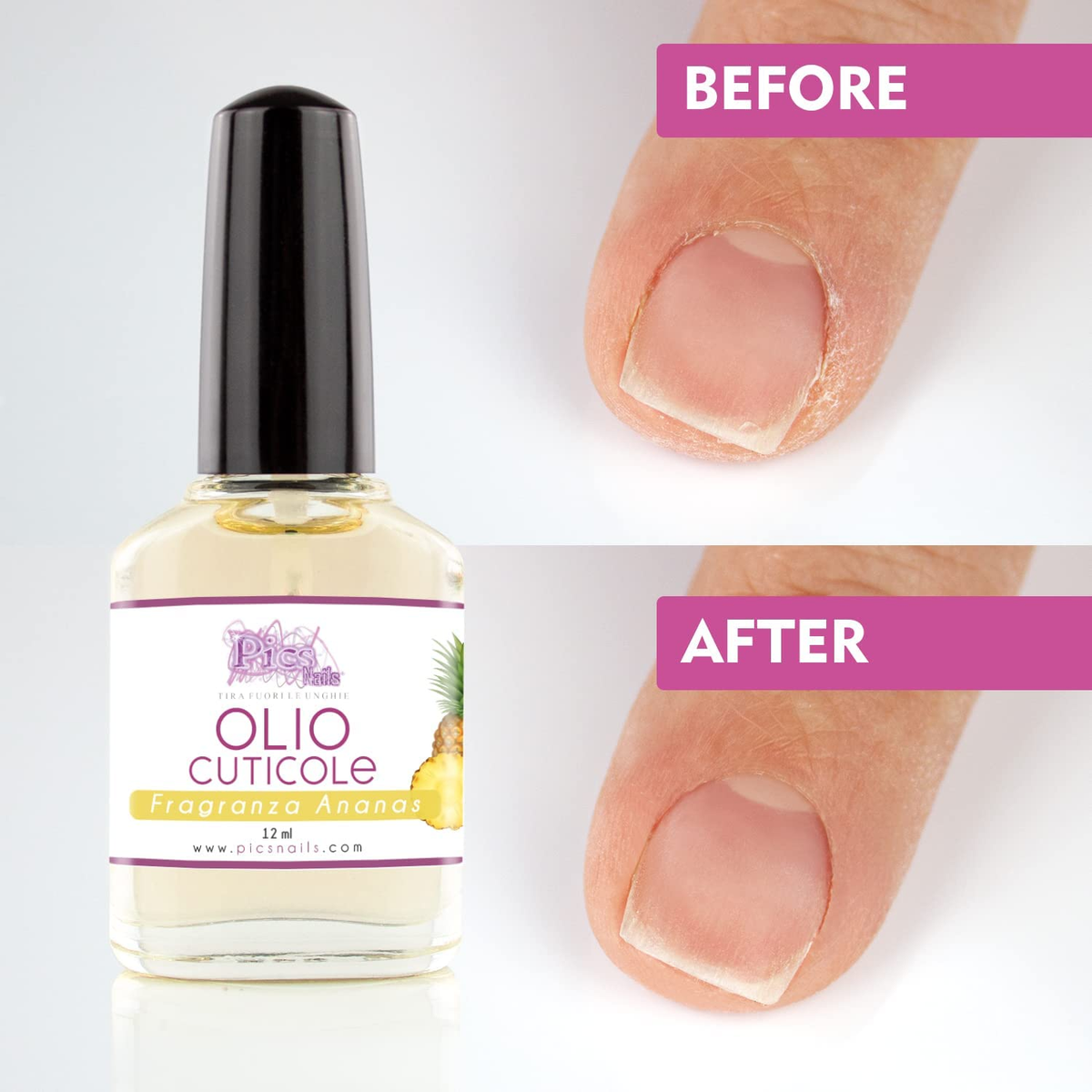 Pineapple Cuticle Oil 12ml